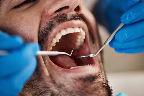 Best Emergency Dentist for Knocked-Out Tooth in Craig, AK